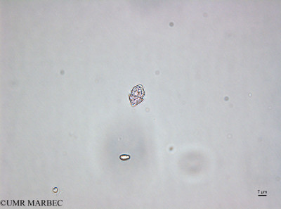 phyto/Brazilian_Amazon_coast/Amazomix_station_2/AMAZOMIX September 2021/Heterocapsa sp2 (St2_heterocapsa220912_001_ovl-10).tif(copy)_thumb.jpg